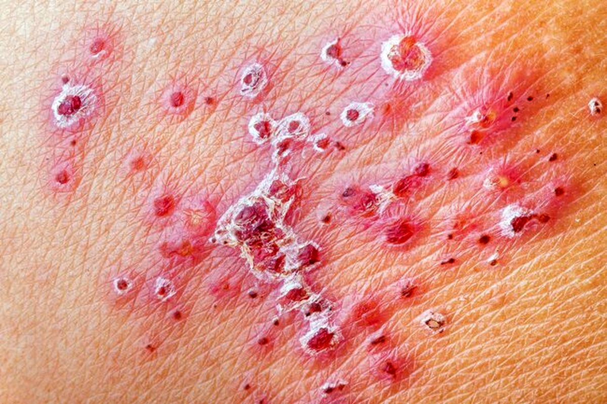 ضایعات پوستی چه میزان خطرناکند؟